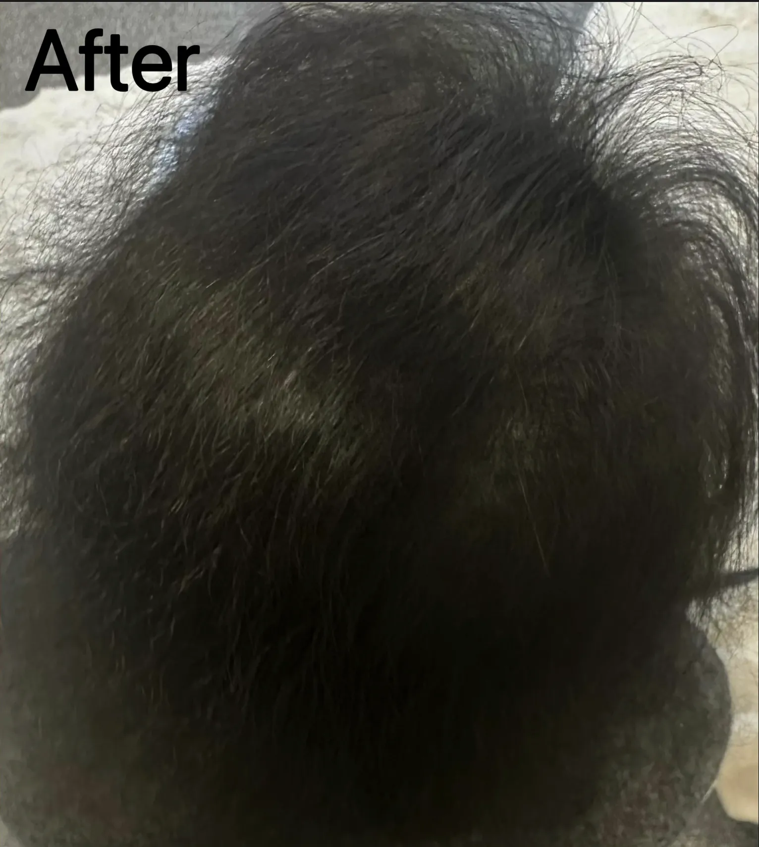 After