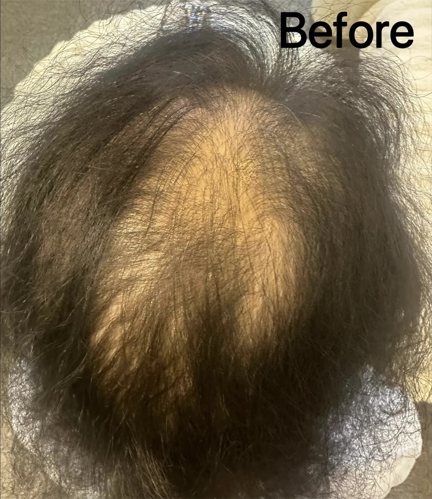 Before